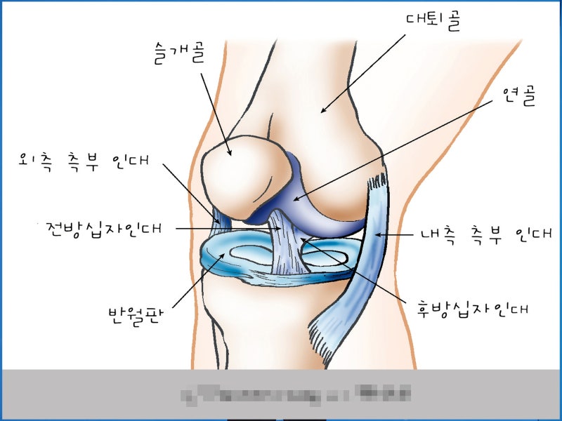무릎통증 원인, 전방십자인대 파열 증상부터 치료 재활까지