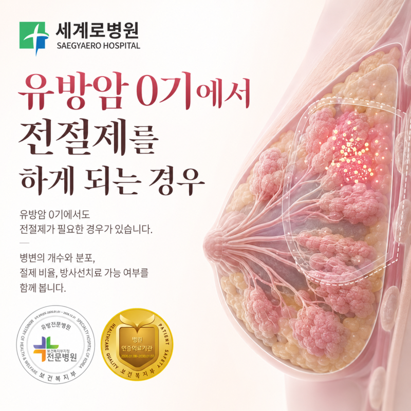 유방암 0기에서 전절제를 하게 되는 경우