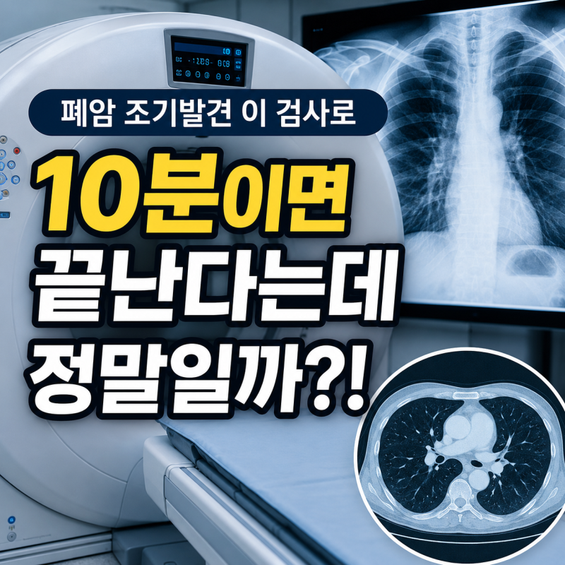 폐CT 비용과 시간 저선량 CT까지 총정리