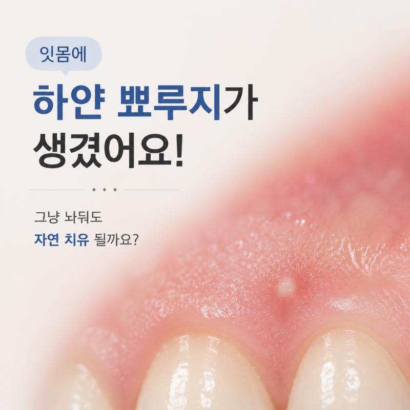 서울두정치과) "잇몸에 하얀 뾰루지가 생겼어요!" 그냥 놔둬도 자연 치유 될까요?