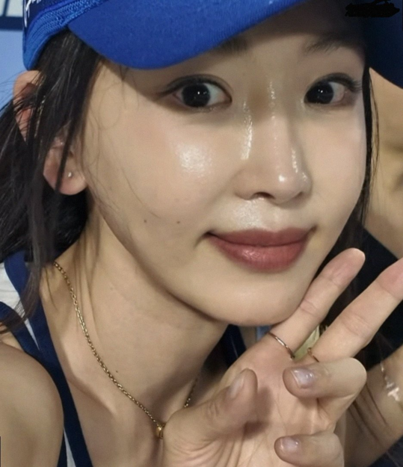 강예원 앞트임 복원 7번 성형 고백과 11억 채무 극복 근황