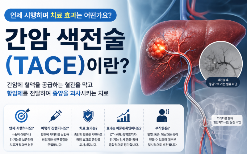 간암 색전술(TACE)이란? 언제 시행하며 치료 효과는 어떤가요?