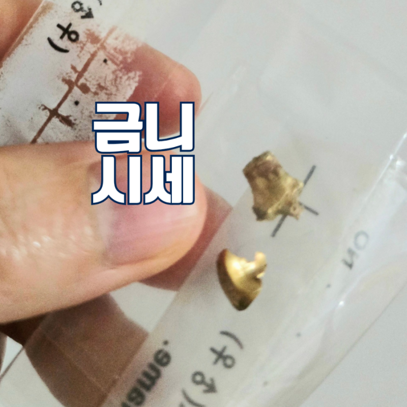 금니 시세 인레이 매입가 폐금 금이빨 판매 가격