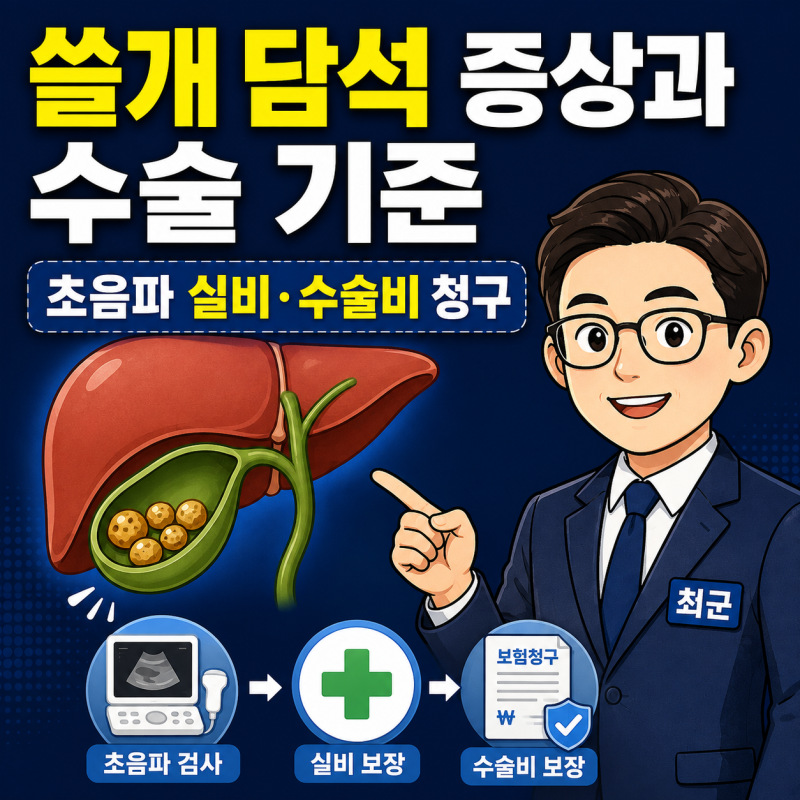 쓸개 담석 증상과 수술 기준, 복부초음파 실비·수술비 청구