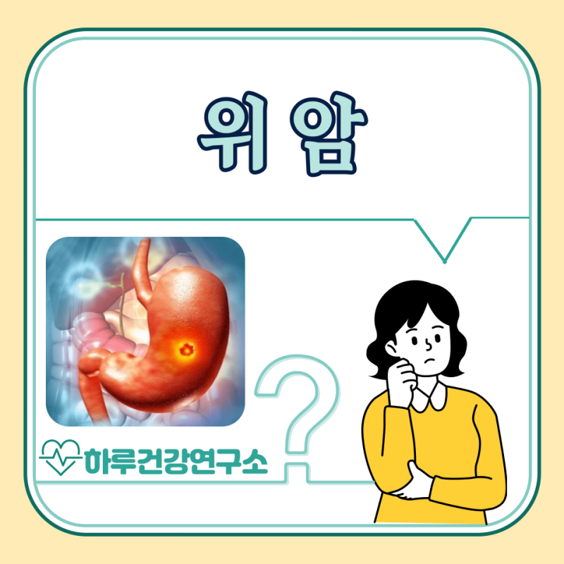 위암 초기 증상, 원인, 치료 : 1기 2기 3기 4기 생존율