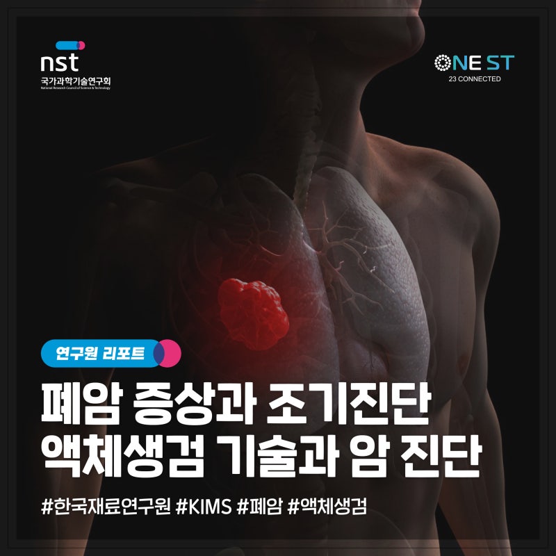 폐암 초기증상부터 체액 검사까지, 혈액·소변 통한 액체생검 기술이 바꾸는 암 진단