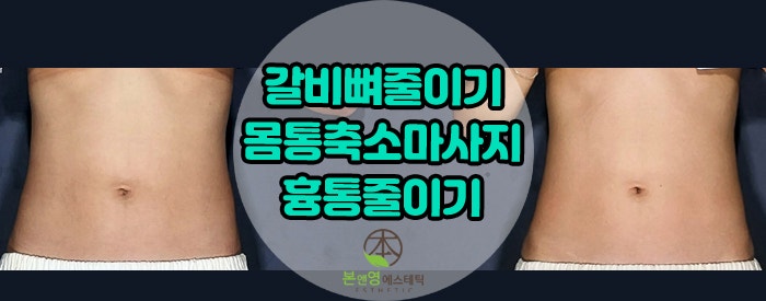 벌어진늑골/흉곽/갈비뼈줄이는 흉통축소마사지_잠실체형관리 본앤영