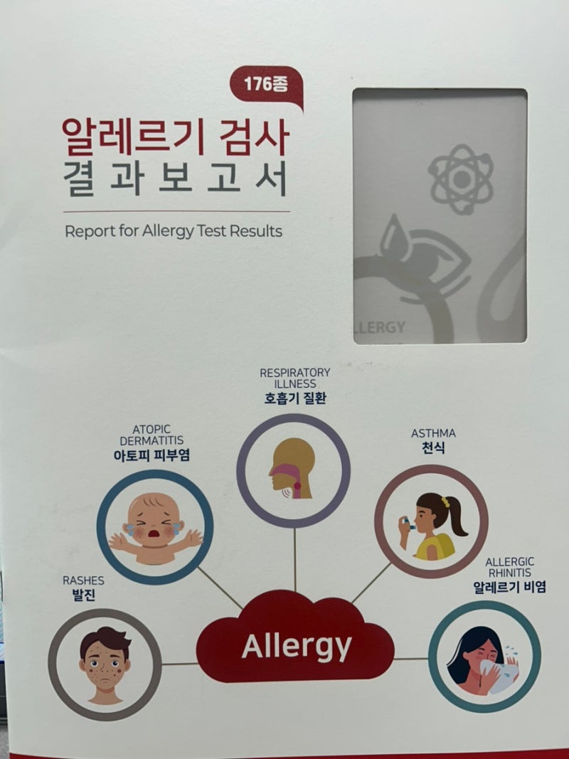 [MAST 알레르기 검사]알러지 검사 후기/비용 및 실비