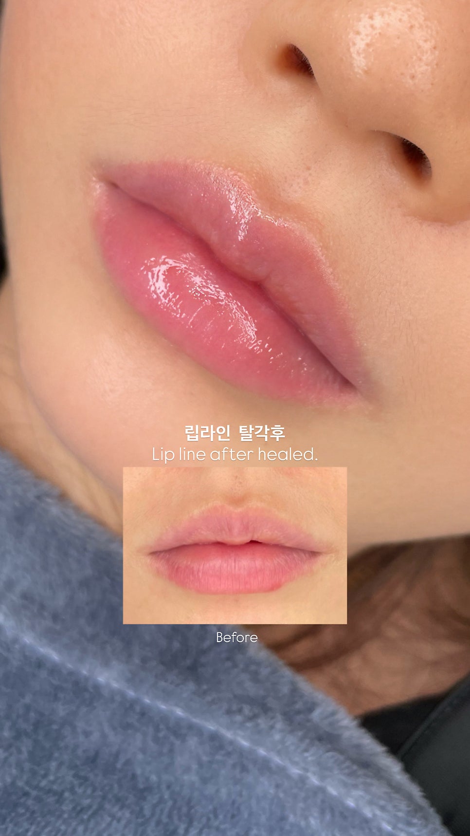 입술 사진 3