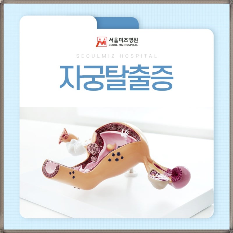 자궁탈출증 원인 치료 말하기 부끄러워 미루셨나요