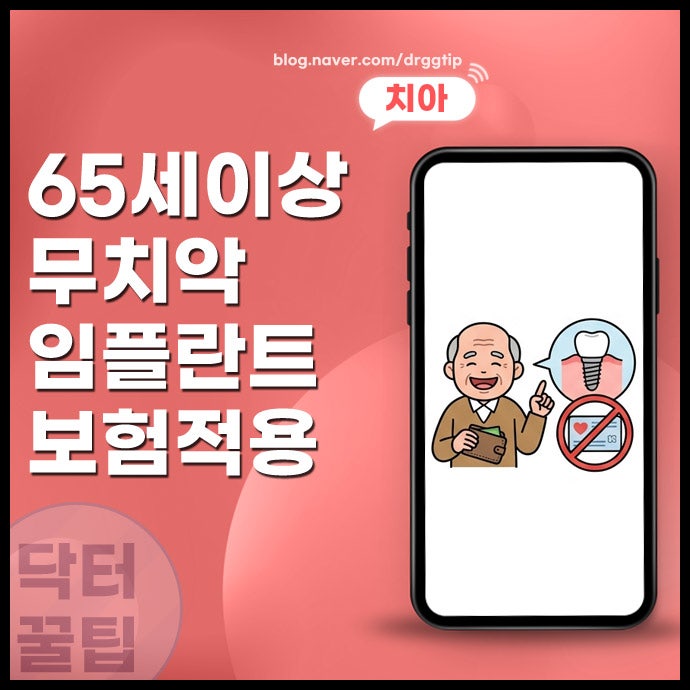 65세 이상 무치악 임플란트 건강보험 대상 조건 본인부담금 지원금 혜택 신청방법