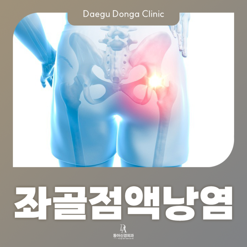 앉을 때 엉덩이 찌릿 좌골점액낭염 증상과 위치, 치료는 어떻게? : 대구신경외과병원