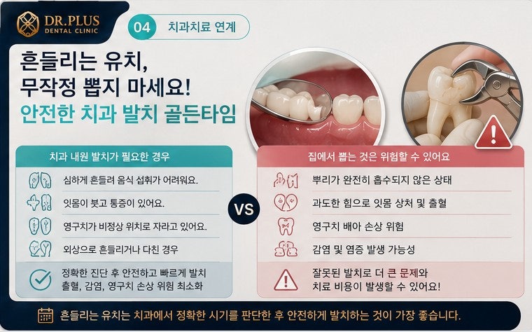 유치의 생리적 흡수와 탈락 (Shedding)