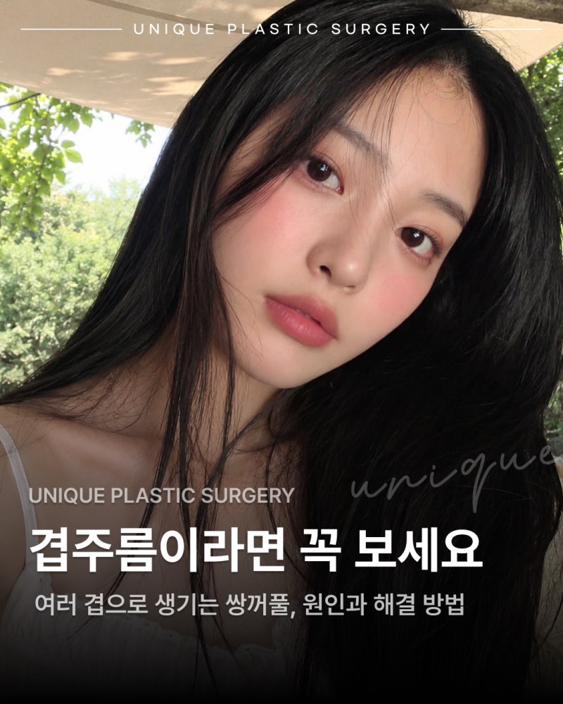 겹주름 원인, 여러겹으로 생기는 쌍꺼풀 라인 개선방법