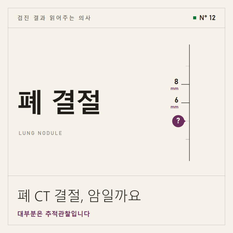 폐 CT 결절, 암일까요? 6mm가 첫 갈림길!