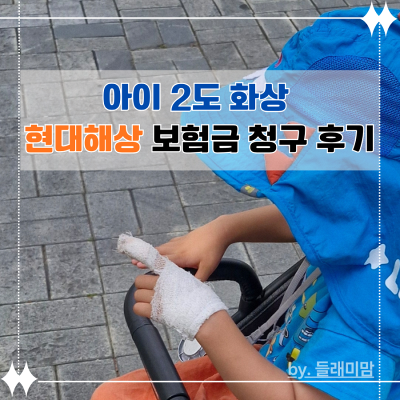 현대해상 표재성 2도 화상 보험금 청구&수령 후기[보험금 적은 이유]