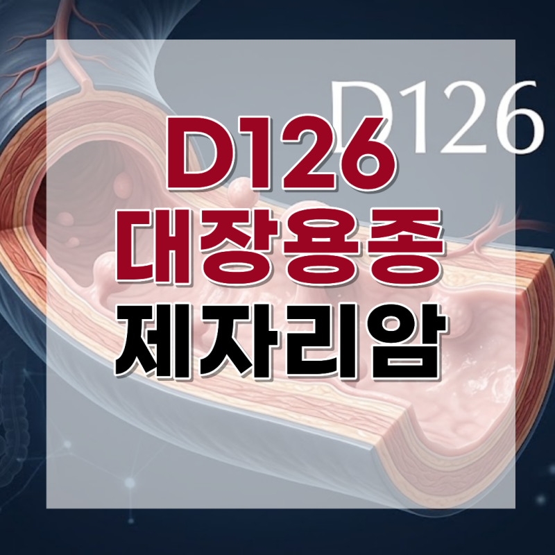 대장 용종 D126 진단서의 비밀, 코드 변경 없이 제자리암진단비 챙기는 기준