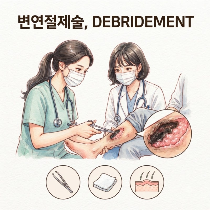 DEBRIDEMENT 변연절제술 뜻과 시행하는 이유