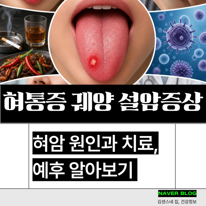 반복되는 혀통증 혀궤양, 설암 혀암 초기 증상 원인 및 치료