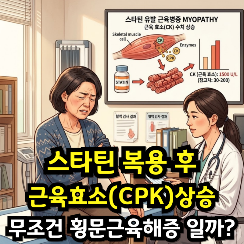 스타틴 복용 후 근육효소(CPK) 상승, 무조건 횡문근융해증일까?