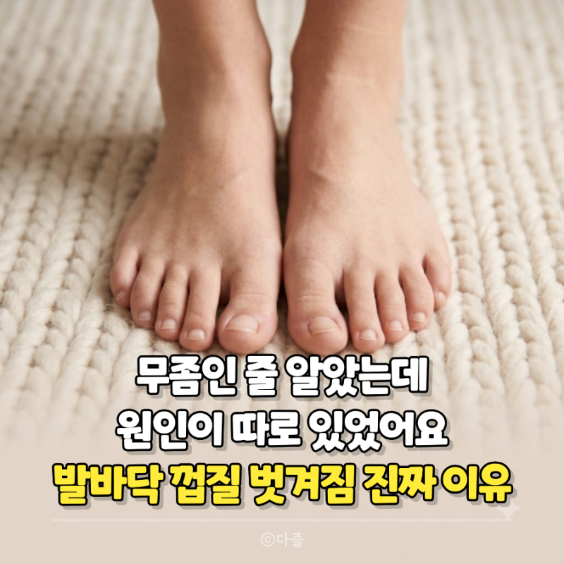 발바닥껍질벗겨짐이유, 무좀인 줄 알았는데 원인이 따로 있었습니다