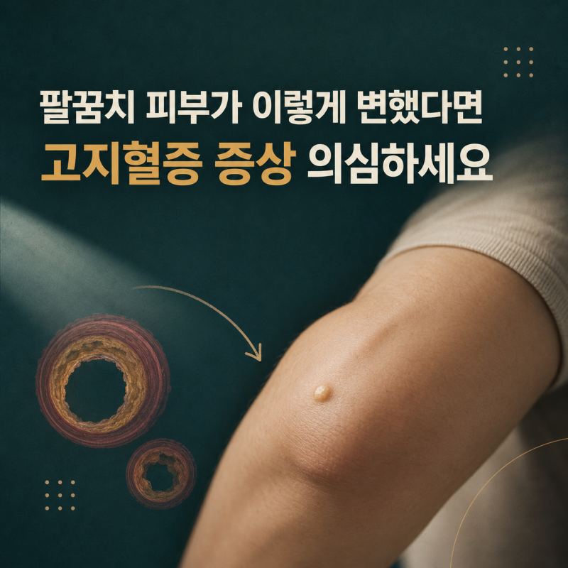 "팔꿈치 피부가 이렇게" 변했다면 고지혈증 증상 의심하세요
