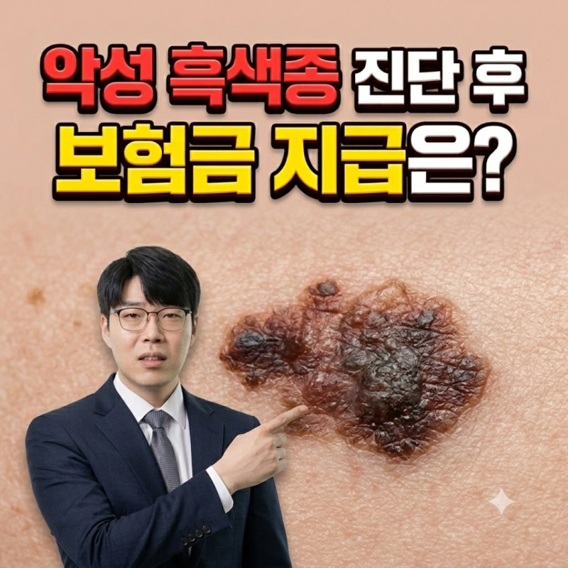 흑색종 악성 진단받으면 보험금은 어떻게 받나요?
