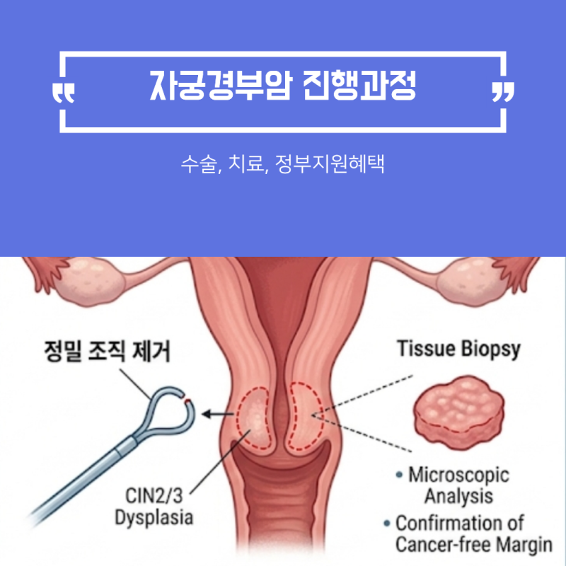 HPV 바이러스 진행과정부터 수술, 치료, 정부지원혜택 총정리