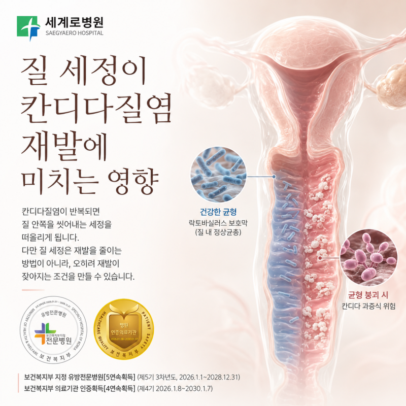 질 세정이 칸디다질염 재발에 미치는 영향