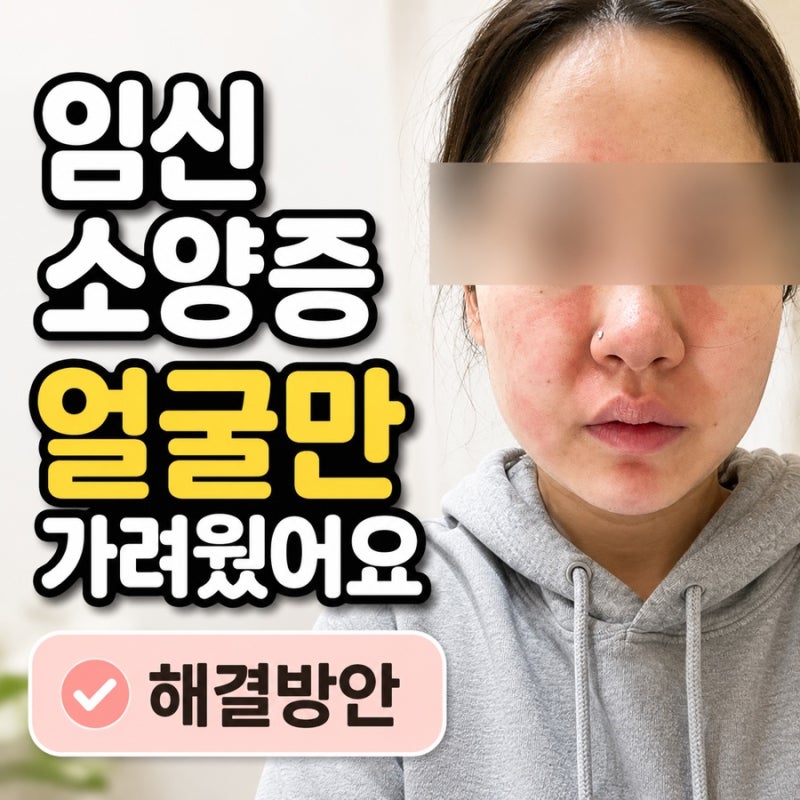 임신 소양증 얼굴 간지러움, 밤마다 미쳐버릴 것 같았던 후기 (+해결방법)