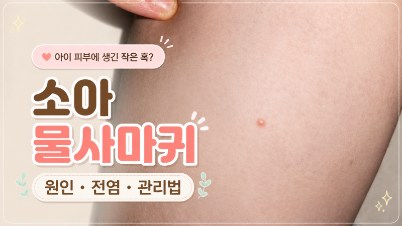 소아 물사마귀 자꾸 번지는 이유 원인과 제거 방법