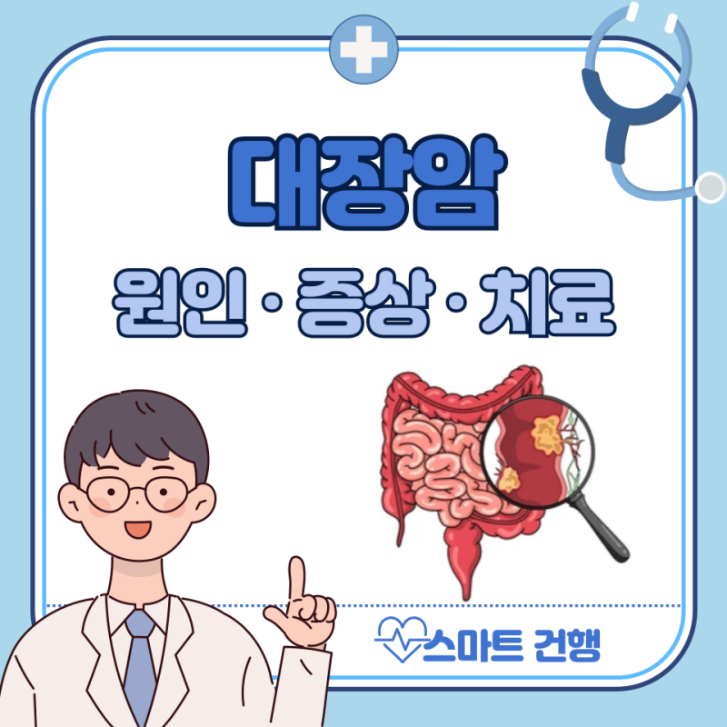 대장암 초기 증상, 원인, 치료 : 3기 4기 생존율