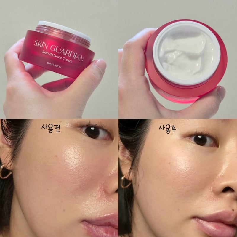 피부붉은기와 얼굴열감 케어엔 스킨가디언 홍조크림 강추