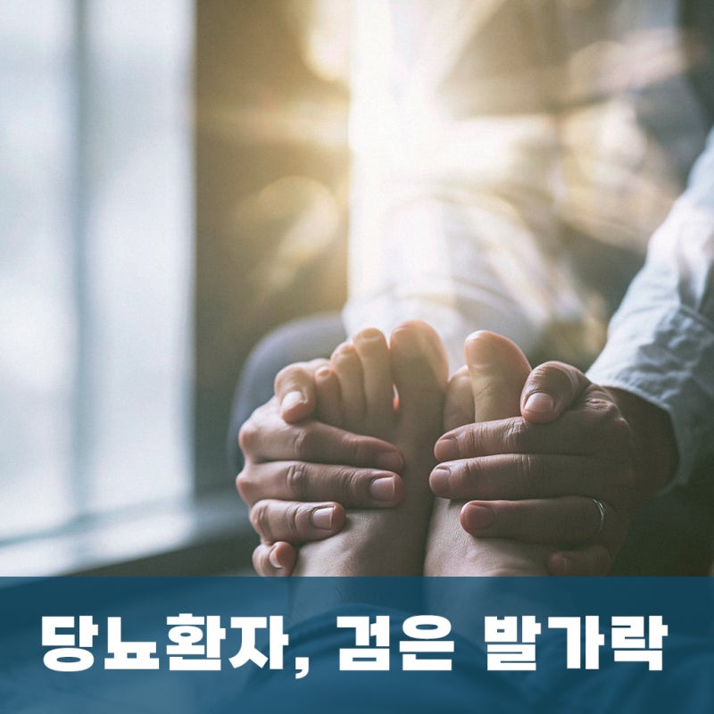 부산 당뇨 환자 발가락 상처가 검게 변하면 말초동맥질환을 의심해야 할까요? - 동래 혈관외....