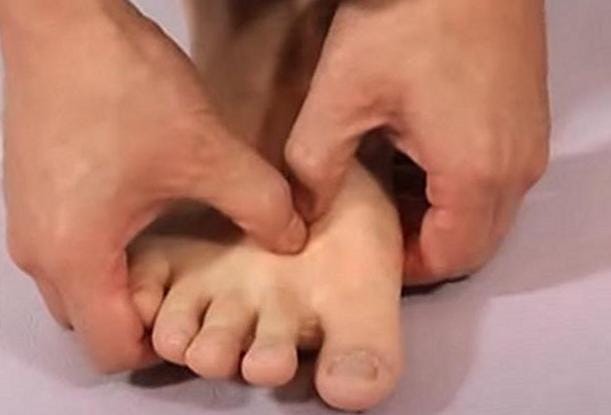 무지외반증 교정기 실제 효과와 착용 시간, 고르는 기준