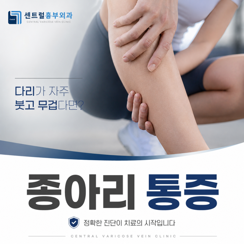 하지정맥류 종아리통증은 왜 발생하는 시간이 중요할까요?