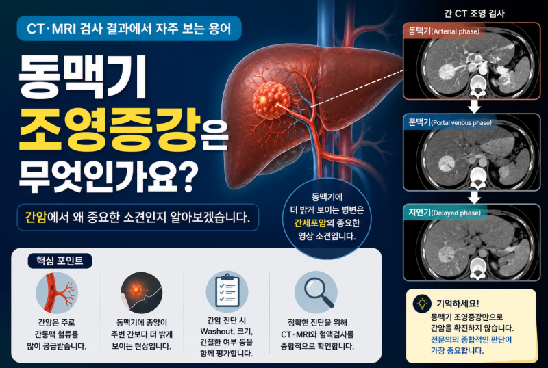 동맥기 조영증강은 무엇인가요? 간암에서 왜 중요할까요?
