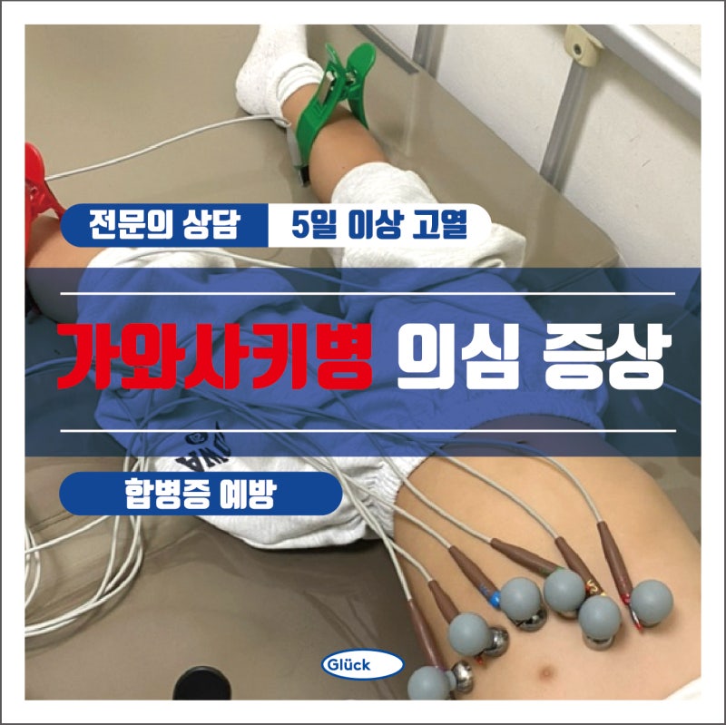 가와사키병 고열이 계속되는 의심증상과 치료방법