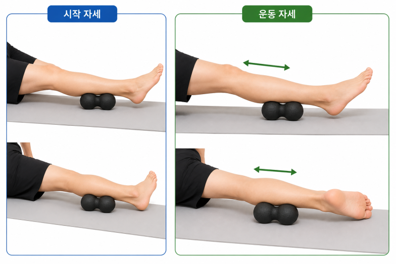 무지외반증 재활운동 5가지｜집에서 따라 하는 발 운동