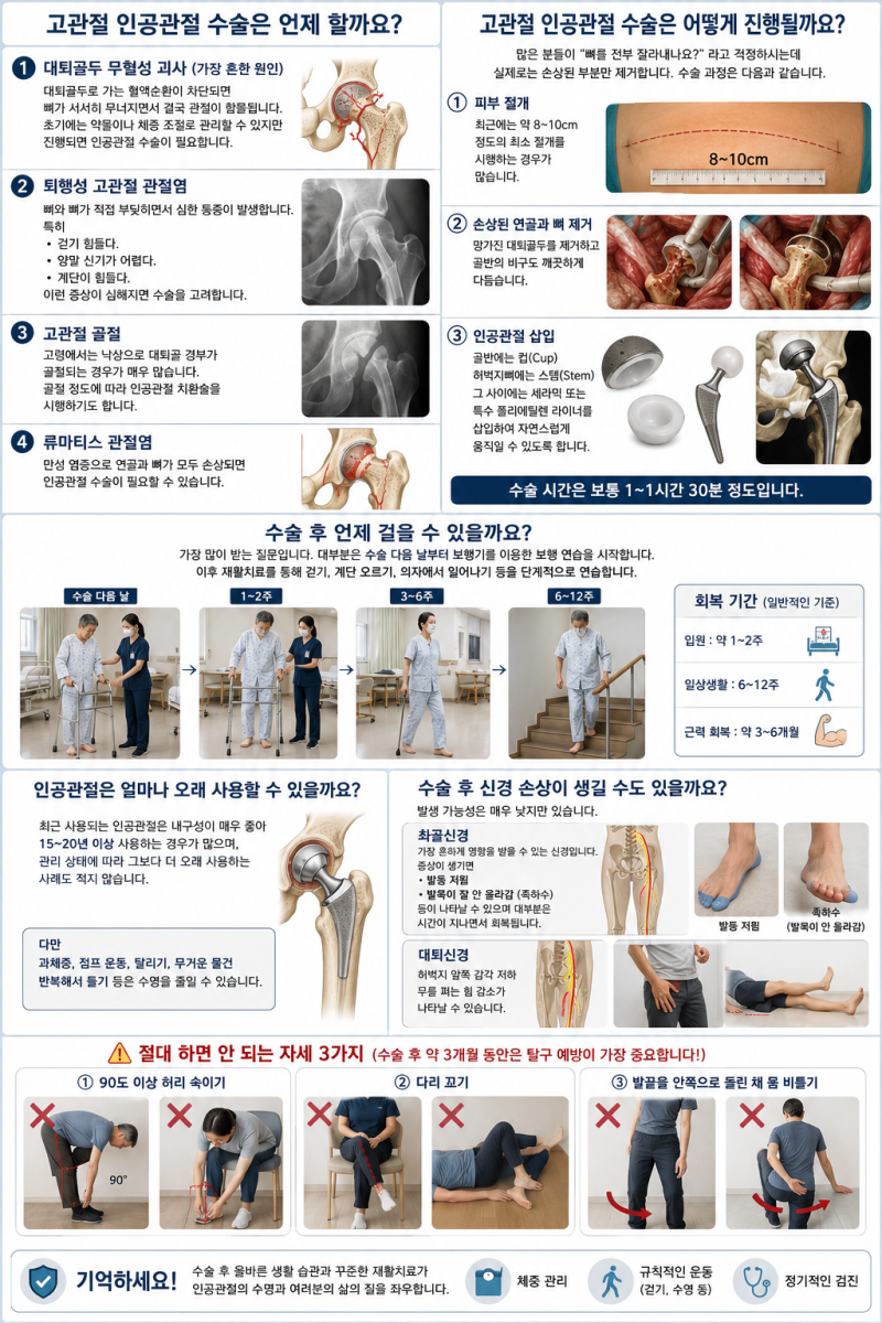 고관절 인공관절 수술, 언제 해야 할까요? 원인부터 수술 과정, 회복기간까지 한 번에 정리 [1....