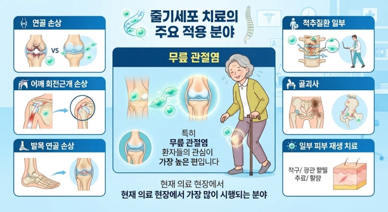 줄기세포 치료란? 비용부터 효과, 장점·단점까지 총정리 (2026년 최신)