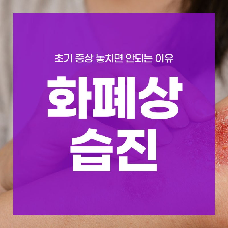 화폐상습진 초기 증상 놓치면 안되는 이유