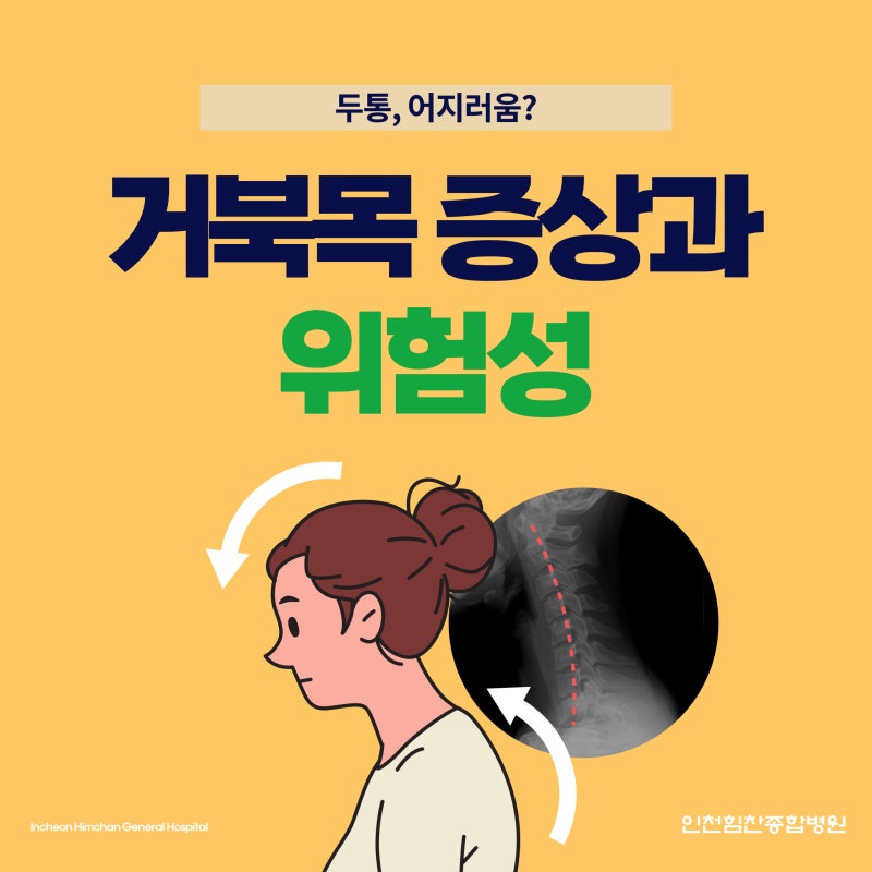 거북목 증상 두통, 어지러움? 거북목증후군 증상과 위험성