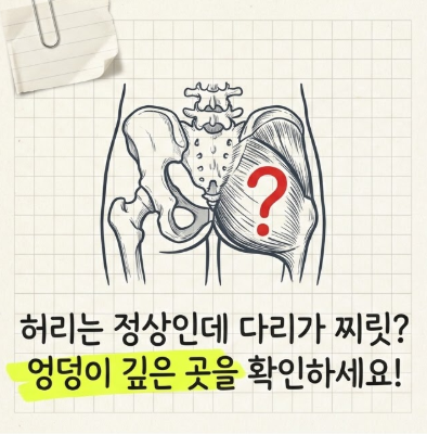 엉덩이가 찌릿하고 다리가 저린 좌골신경통 ｜ 이상근 증후군 도침치료 [서울 도침치료 시리....