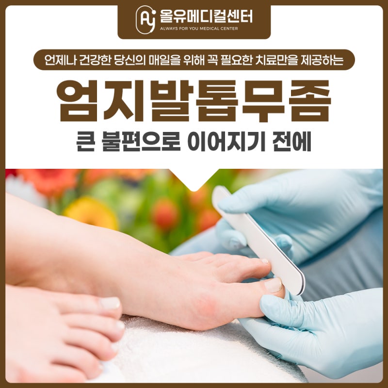 군자 엄지발톱무좀, 왜 하필 엄지에 잘 생길까