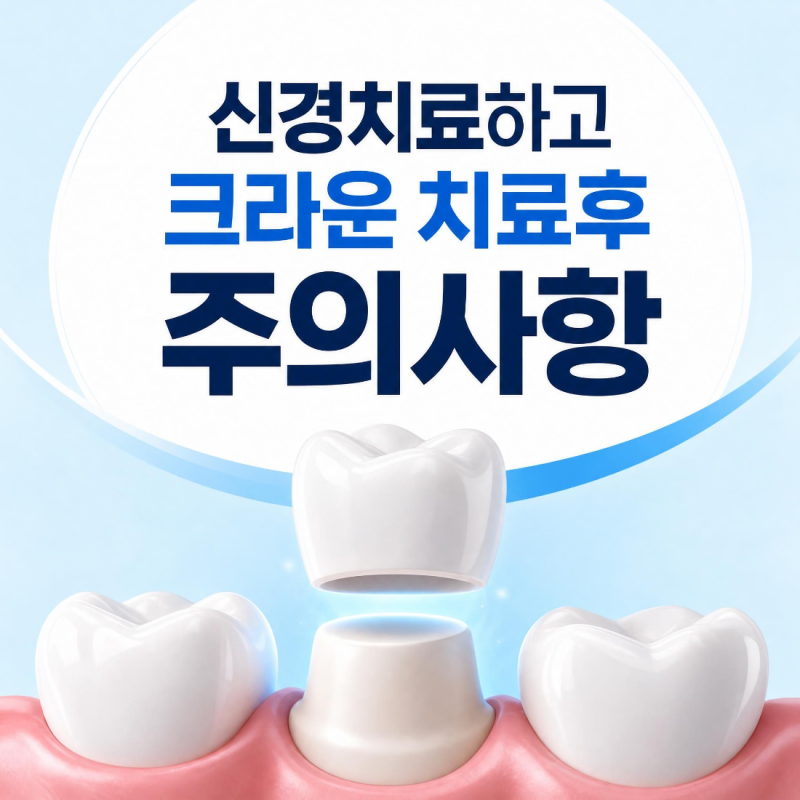 신경치료하고 크라운 치료후 주의사항 (시림,높이조정)