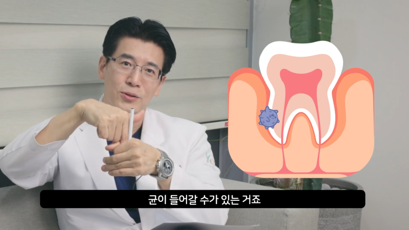 치아보다 무서운 잇몸병, 방치하면 안 되는 풍치 증상과 예방법
