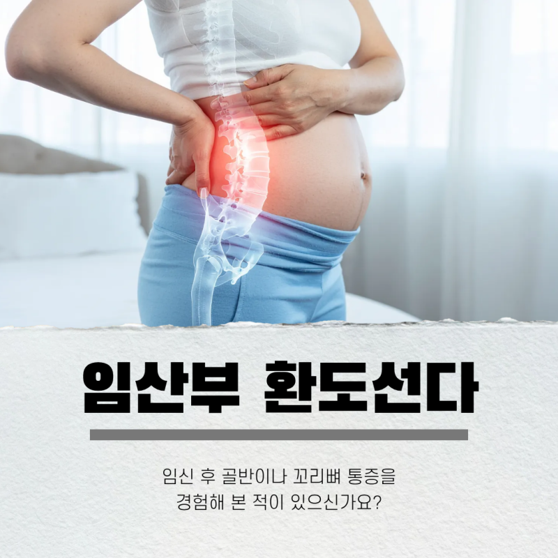 임산부 환도선다 증상 방석 복대 스트레칭, 각각의 효과는?