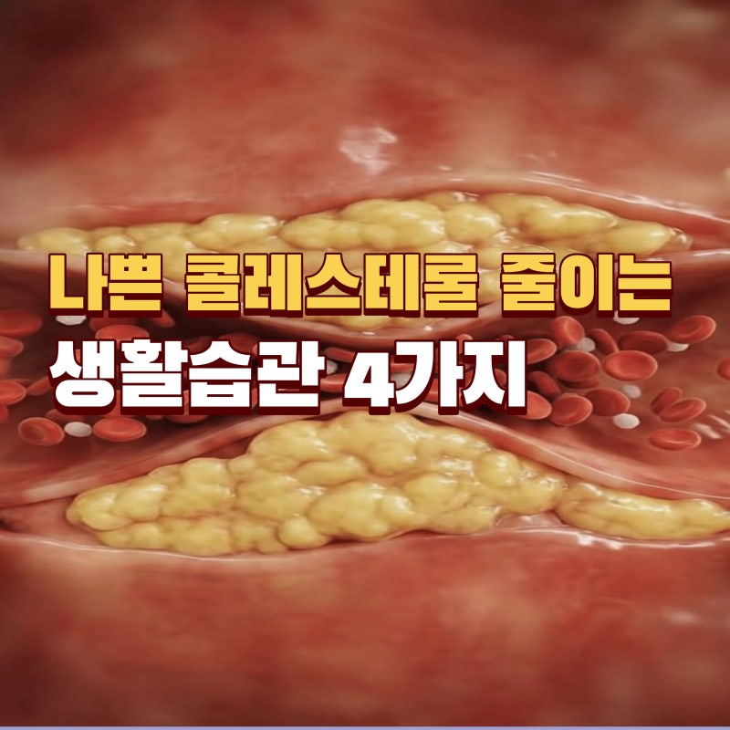 건강검진에서 '콜레스테롤 높음'… 의사들이 가장 먼저 권하는 4가지