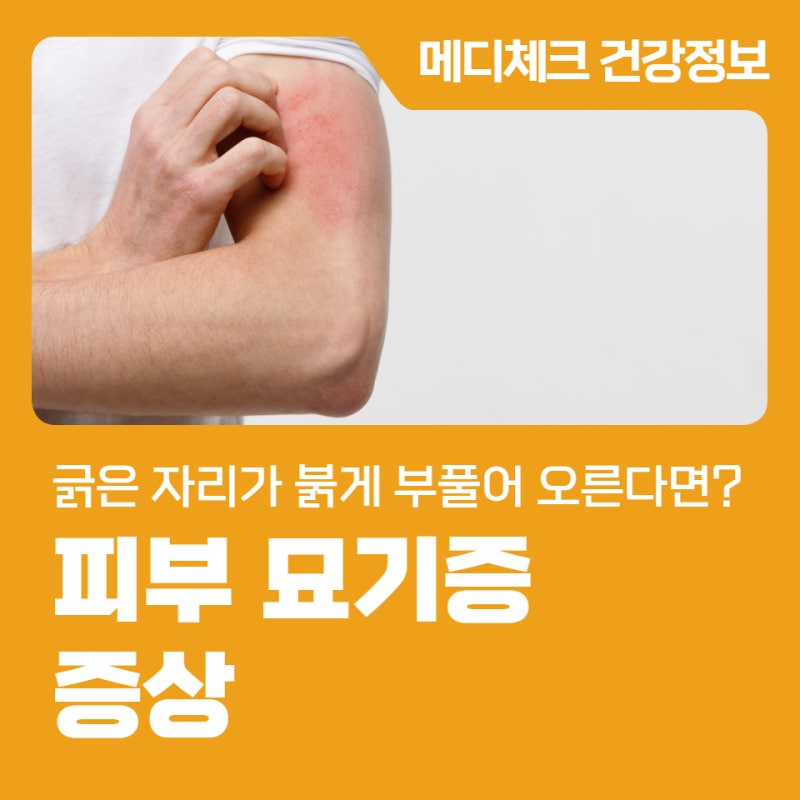 긁은 자리가 붉게 부풀어 오른다면? 피부 묘기증 증상